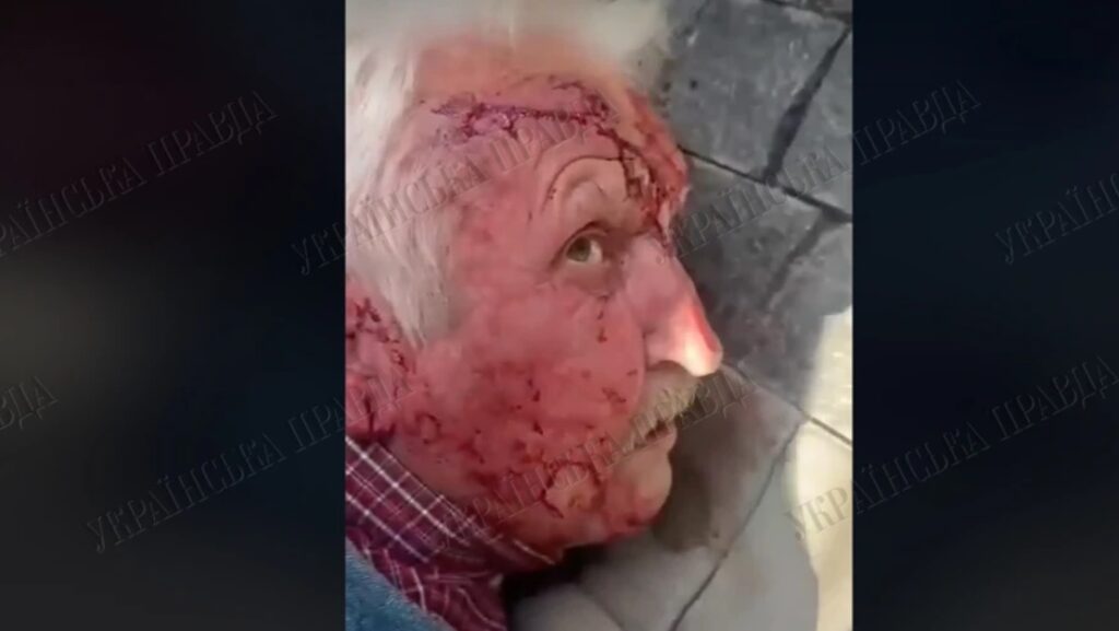 Чоловік, якого підозрюють у спробі замаху на командира Ігоря Оболенського